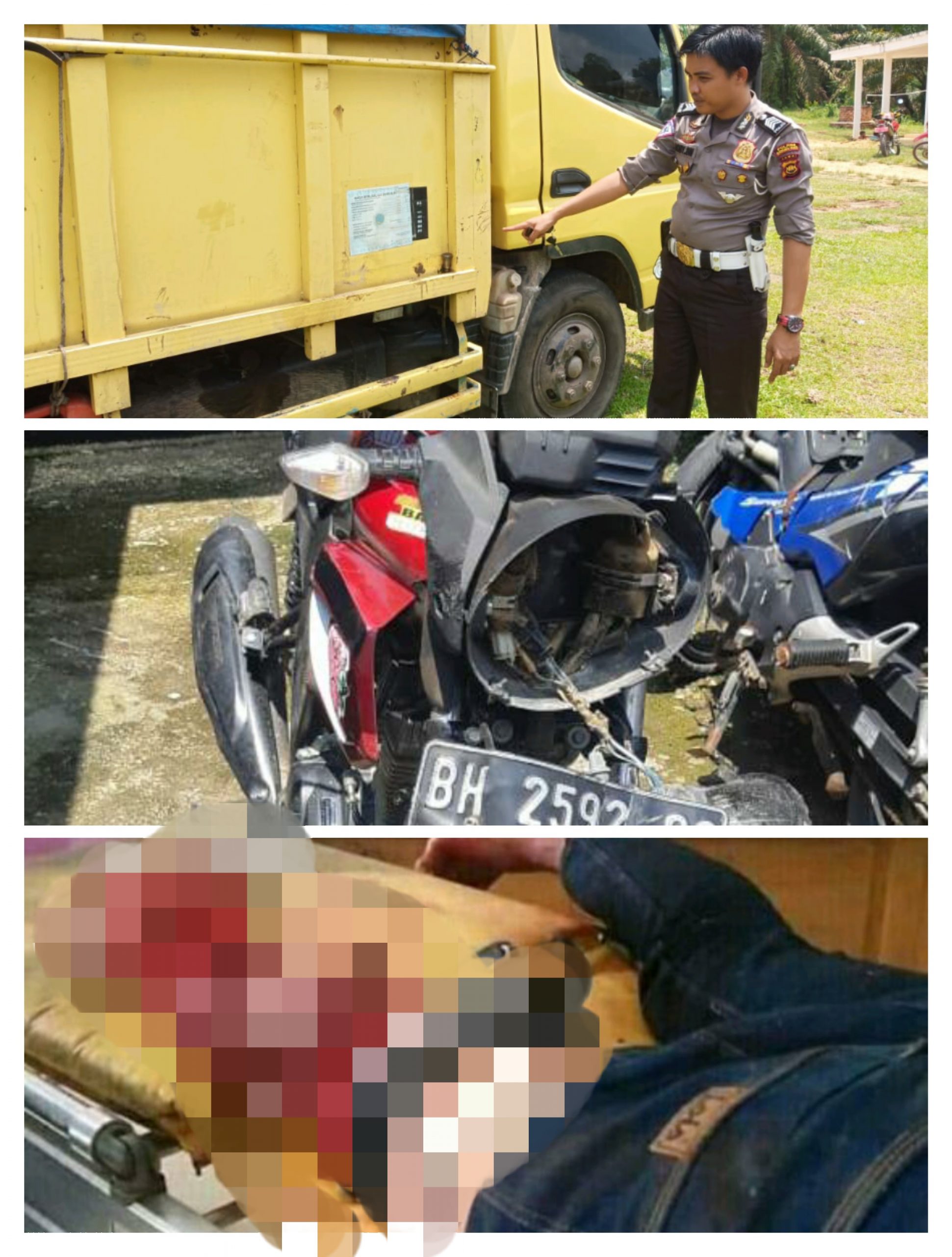 Dua Pemuda Asal Sarolangun Luka Parah Terlindas Truk