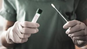 foto-tes-pcr-ilustrasi Harga Tes PCR di Labkesda Kota Jambi Turuna Jadi Rp275 Ribu