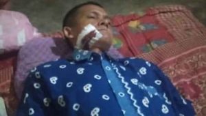 Wartawan Online Mengalami Luka Bacok di Rahang Kiri
