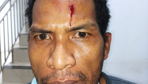 IMG_20220920_114557 Petugas Dinsos Dikeroyok Pengamen Saat Penertiban